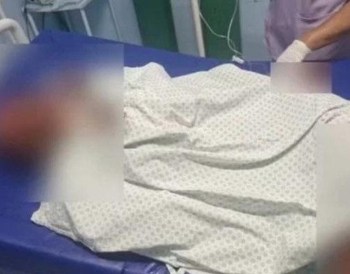 Mulher é esfaqueada por cliente após programa sexual em Demerval Lobão