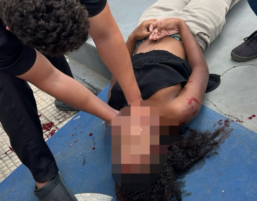 Mulher é arremessada após batida entre moto e carro na zona leste