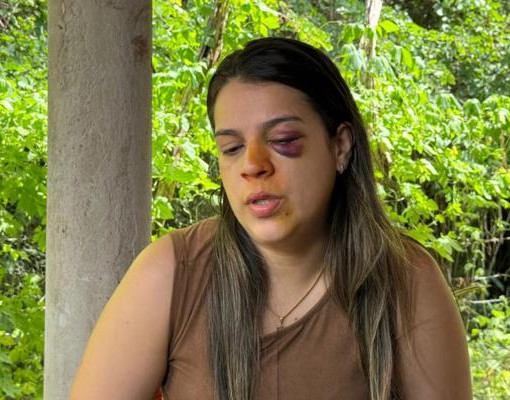 Corretora agredida pelo marido em Teresina passa por exames e tem quadro agravado