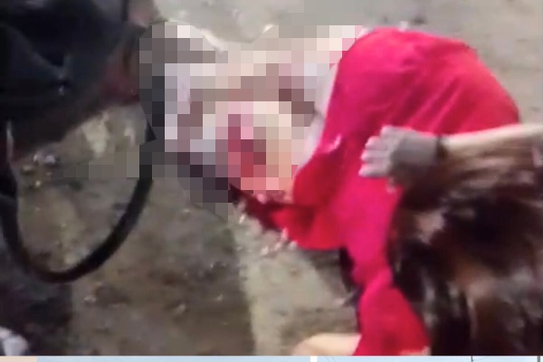 Colisão entre ônibus e motocicletas deixa mulher com fratura exposta em Teresina