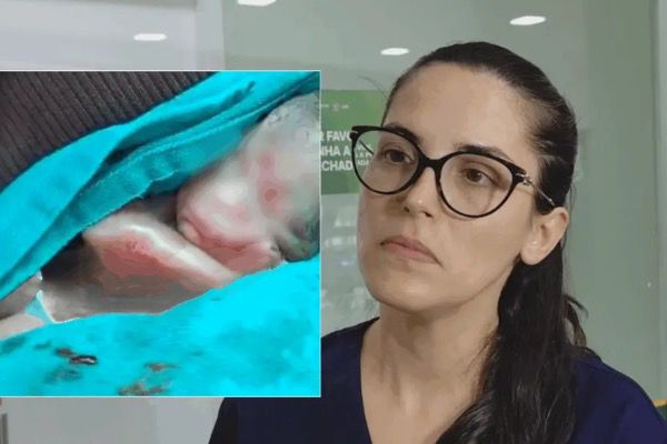 Prematuro de cinco meses surpreende médicos ao voltar a respirar no Acre