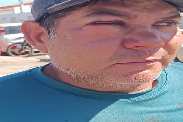 Servidor da Prefeitura de São Raimundo Nonato é agredido por ex-vereador