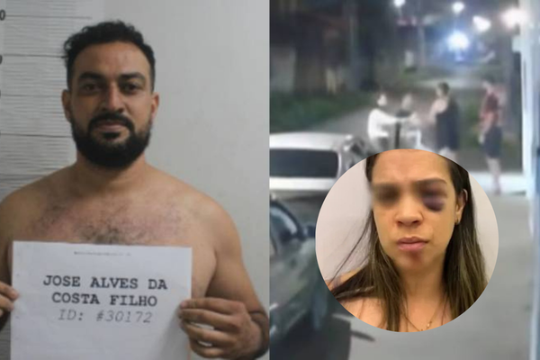 MP recorre contra soltura de homem acusado de agredir companheira em Teresina