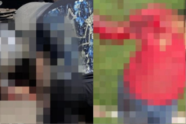 Mulher tem pernas esmagadas e morre após colisão com caminhão em Picos