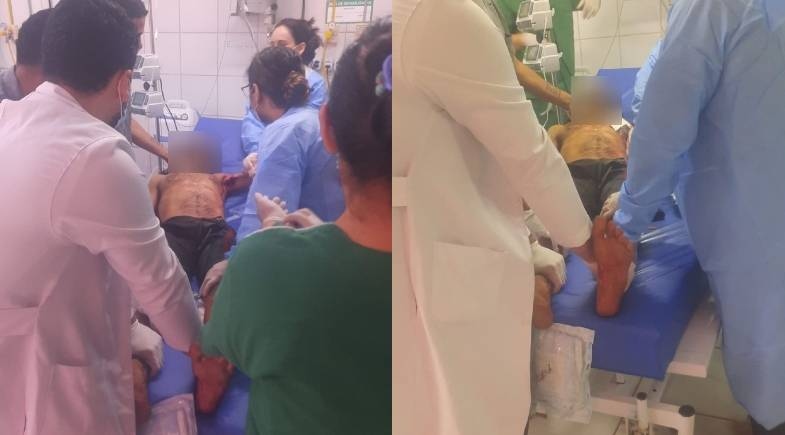 Homem é baleado três vezes em ataque na zona sudeste de Teresina